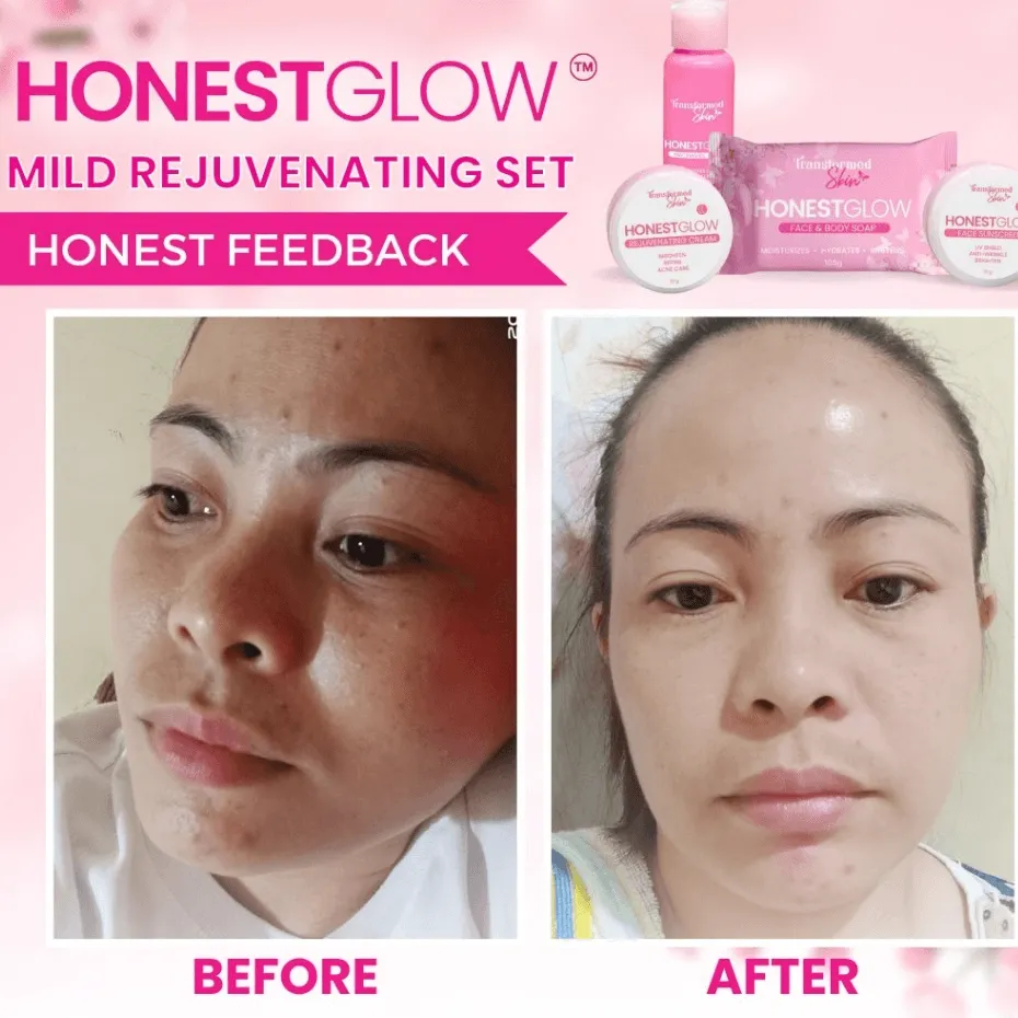 HonestGlow Facial Set Mild Rejuvenating Set